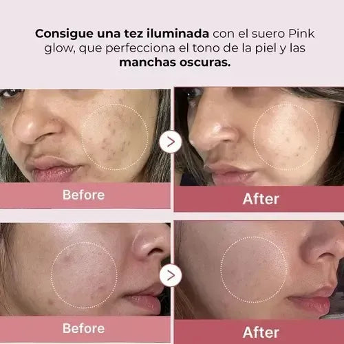 Serúm Medicube Pdrn con peptidos